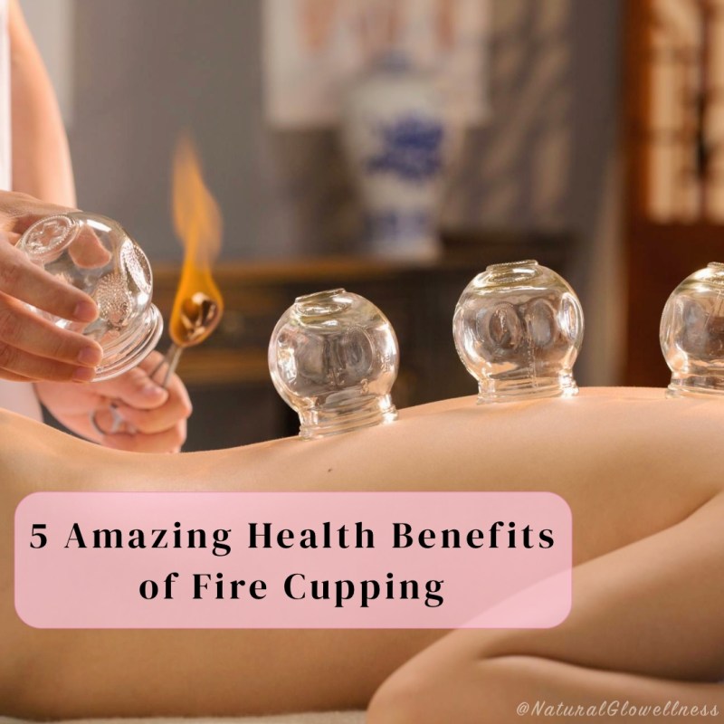5 Amazing Health Benefits of Fire Cupping&nbsp;🔥